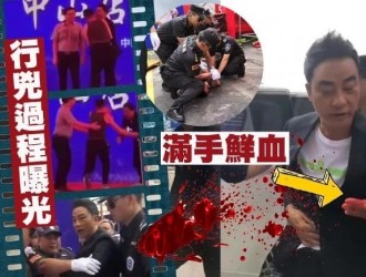 任达华在广东出席活动时被陌生男子捅伤，手上满是血迹